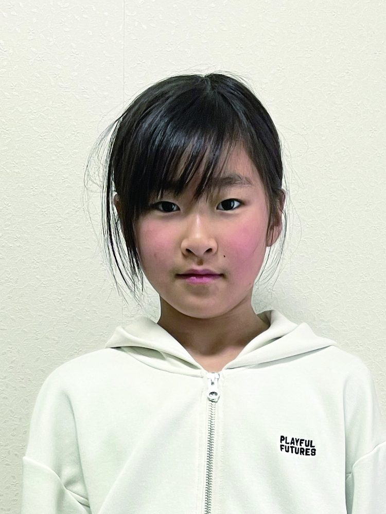 施術前のお顔（目線を入れて掲載しています）